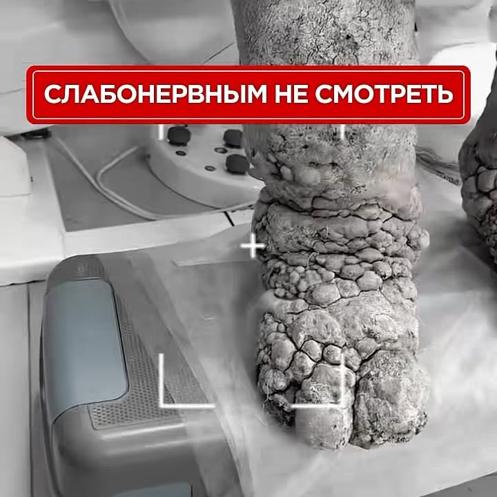 Рилс @dr.ramiz.flebolog