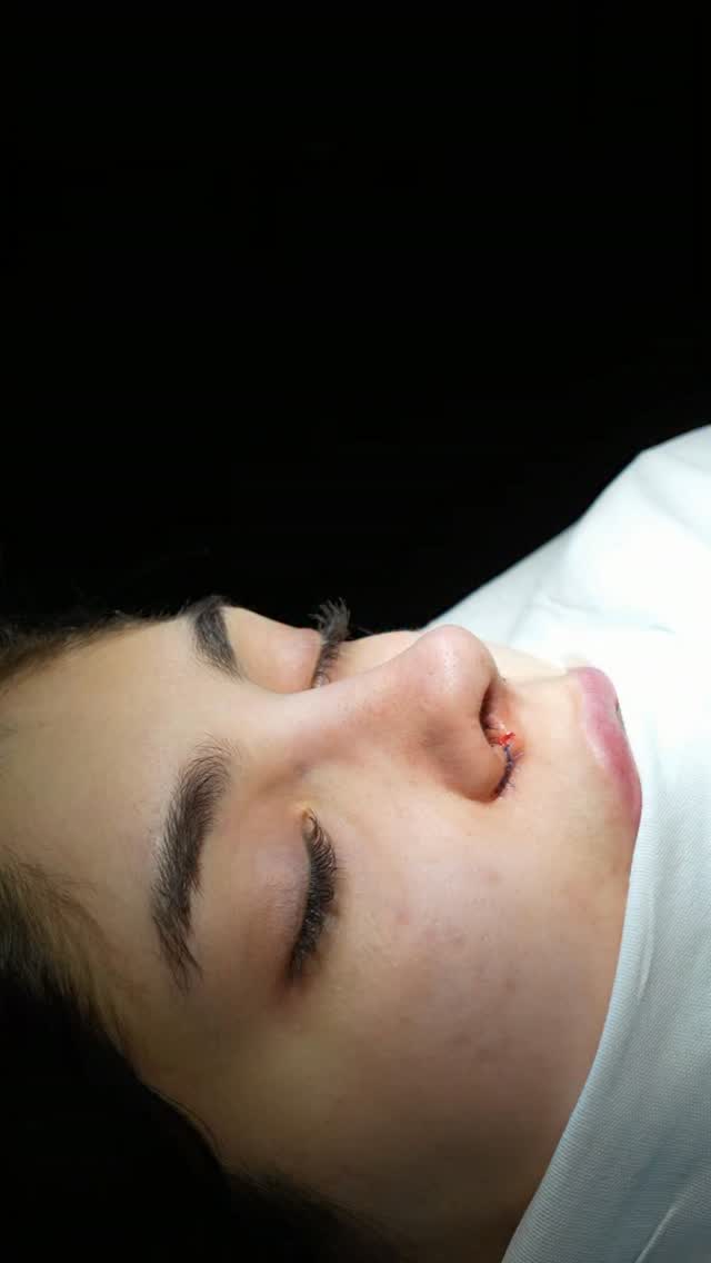 Рилс @amirkhanov_clinic
