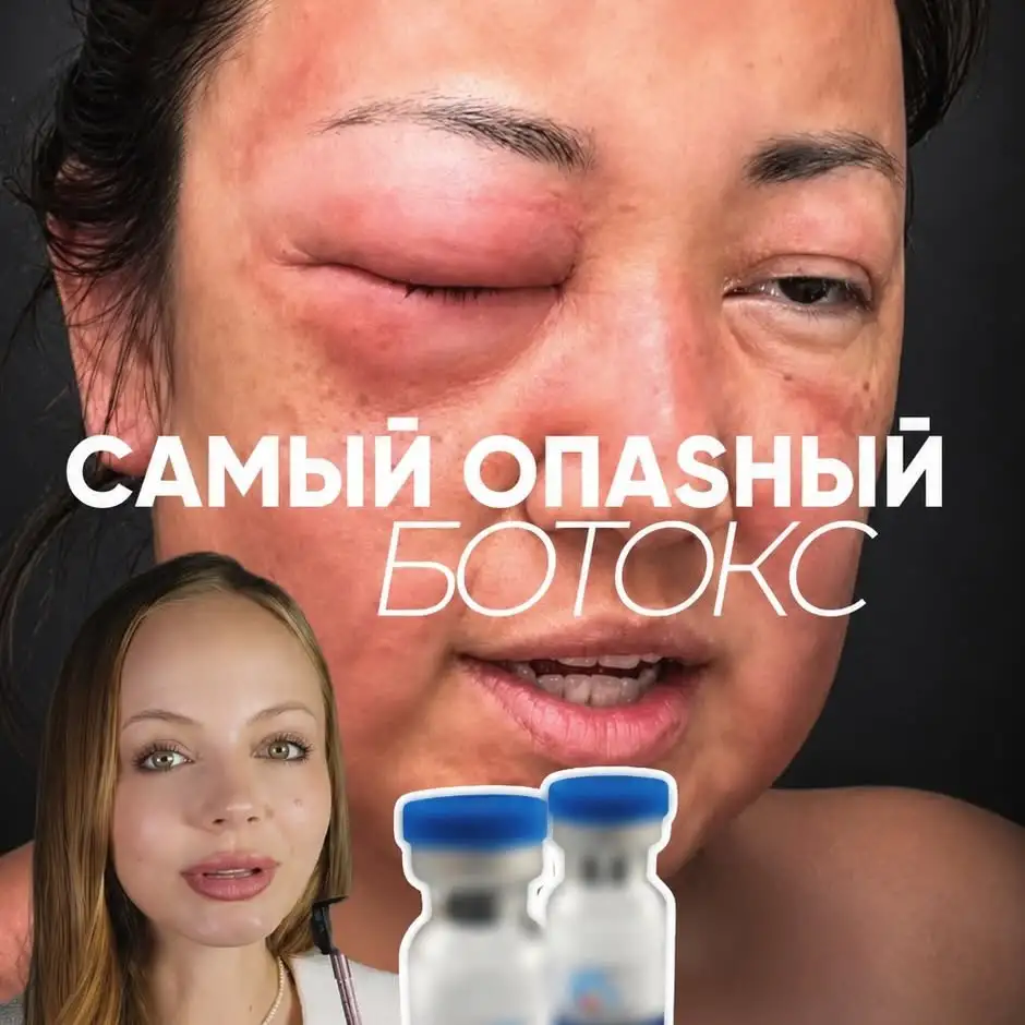 Рилс @olga.derma