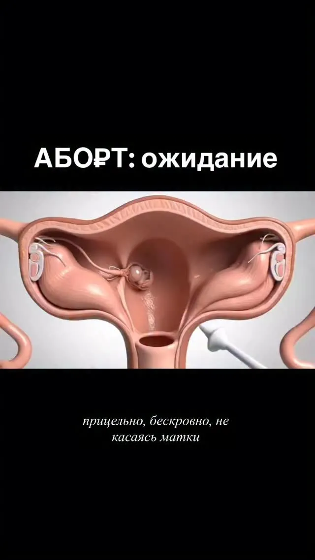 Рилс @ginecolog_morozova