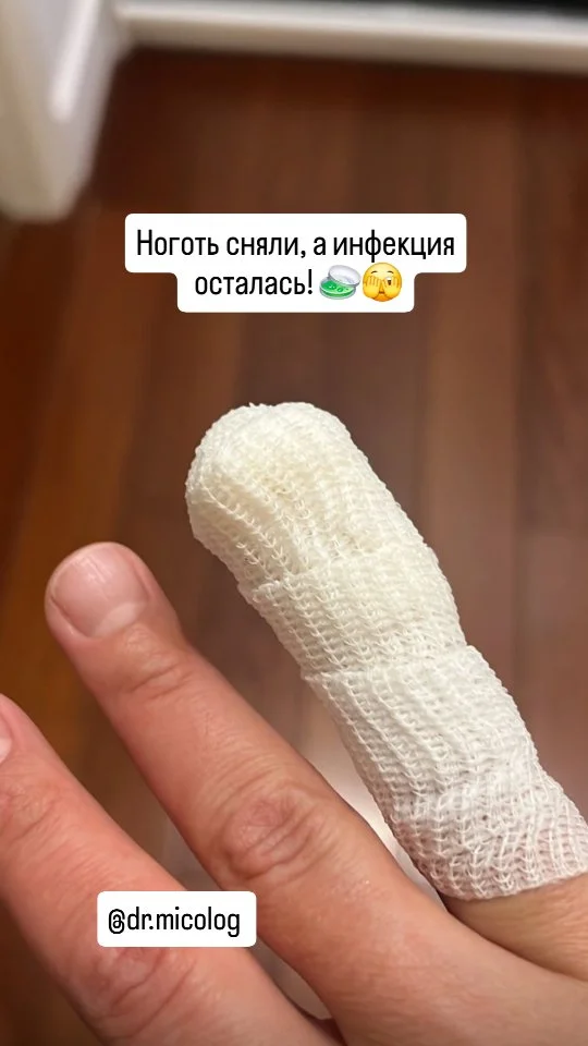 Рилс @dr.micolog
