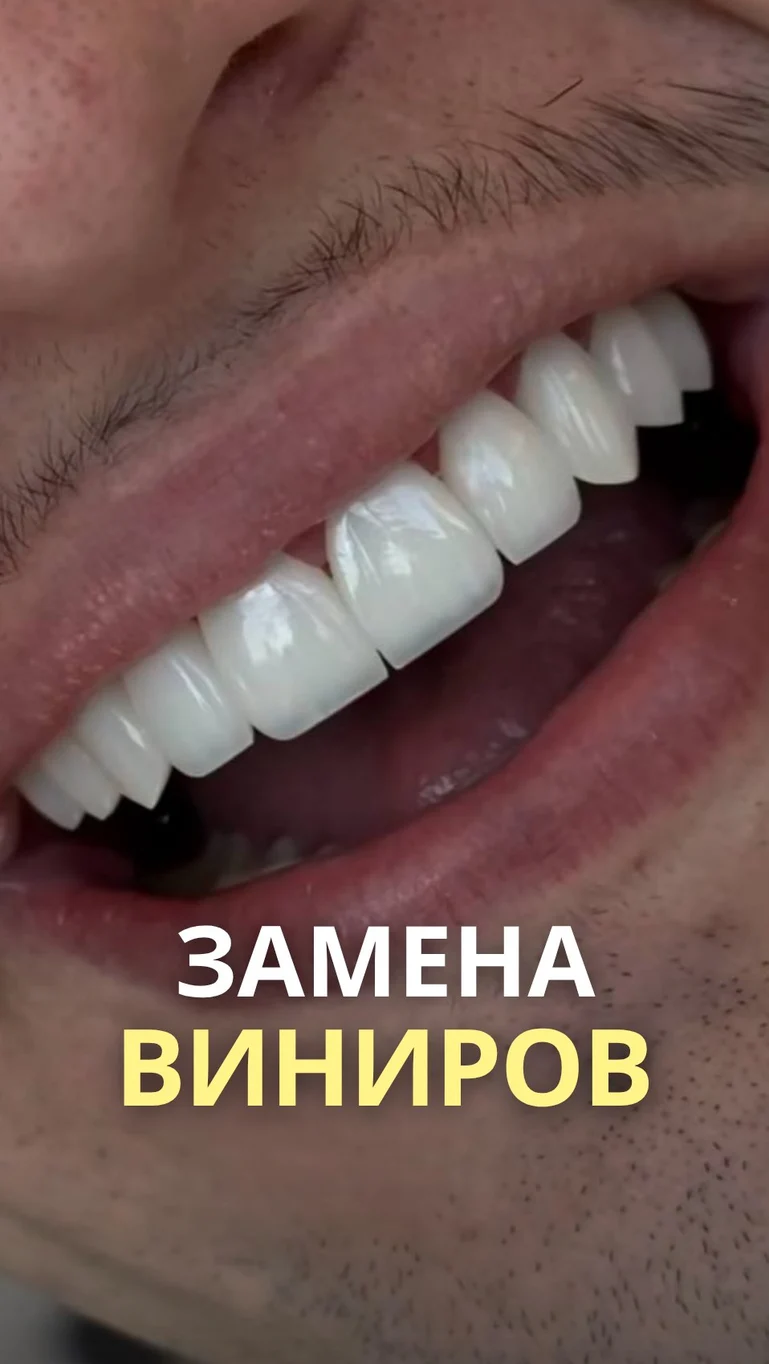 Рилс @dentist_sonya