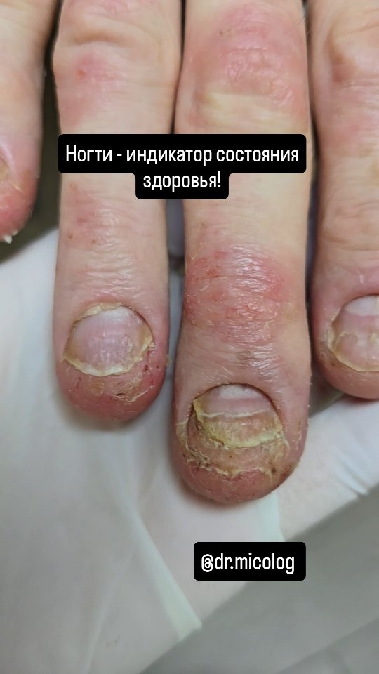 Рилс @dr.micolog