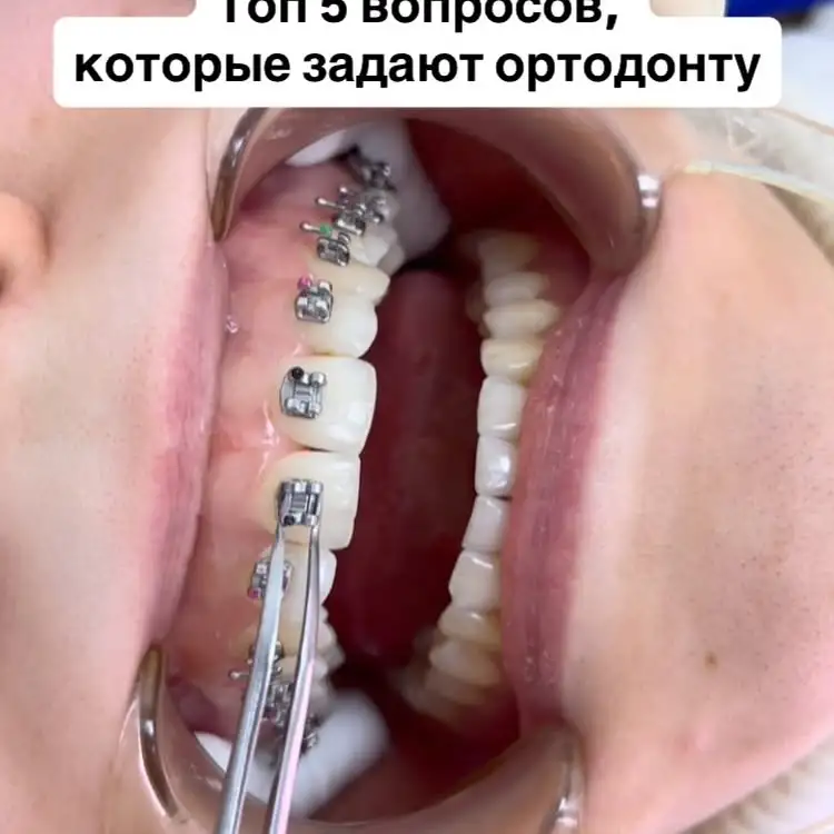 Рилс @dr.tagir_shamilevich