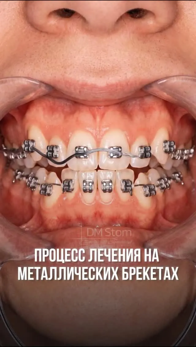 Рилс @damas_denta